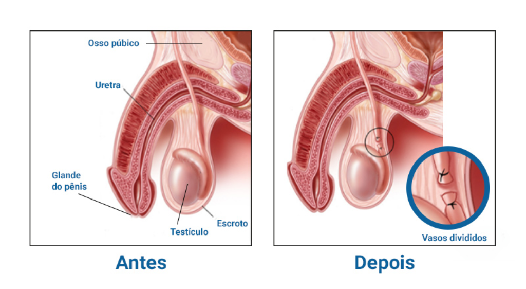 Como funciona sequra